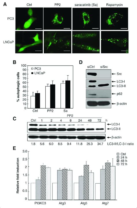 Src Inhibitors Pp2 And Saracatinib Induce Autophagy In Prostate