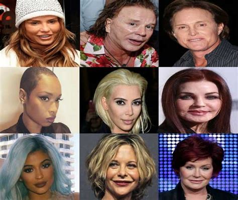 Too Much Plastic Surgery Before And After Worst Celebrity Plastic Surgery