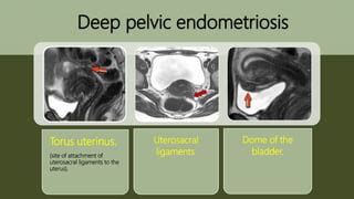 genitourinary signspptx