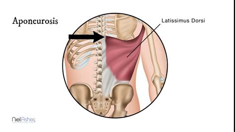 How To Find Trigger Points Latissimus Dorsi Youtube