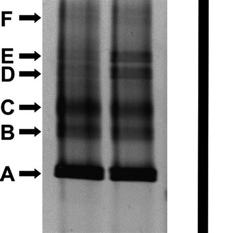 Denaturing Gradient Gel Electrophoresis Dgge Analyses Of The Gene Download Scientific Diagram