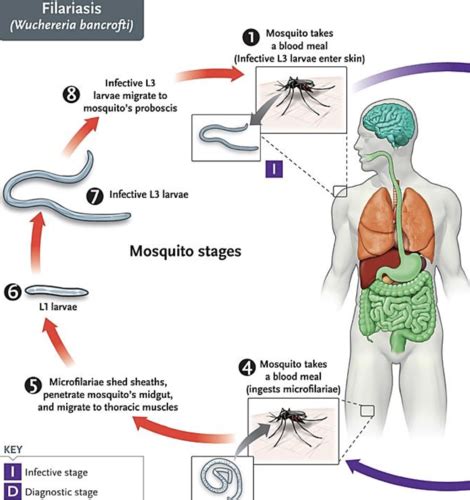 Wuchereria Bancrofti Life Cycle