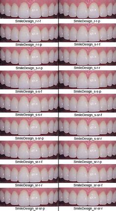 7 Teeth shape ideas | teeth, teeth shape, beautiful teeth