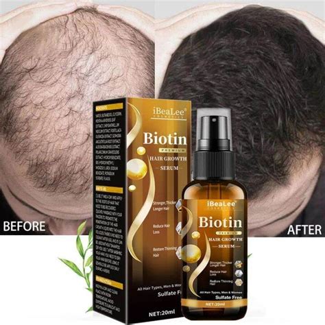 Original Biotin Hair Growth Serum Biotin For Hair Growth Oil Biotin