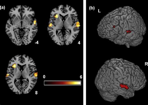 Brain regions with significant activity of auditory perception of ...