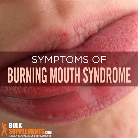 Burning Mouth Syndrome BMS Symptoms Causes Treatment