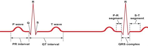 Ecg Diagram Quizlet