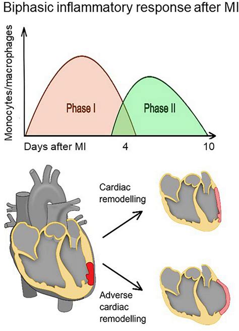 The Healing Of The Myocardium After Infarction Involves Biphasic