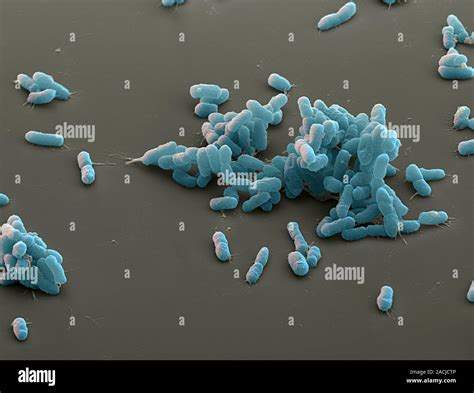 Las bacterias de peste Yersinia pestis color Micrografía análisis de