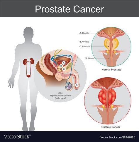 Prostate Anatomy