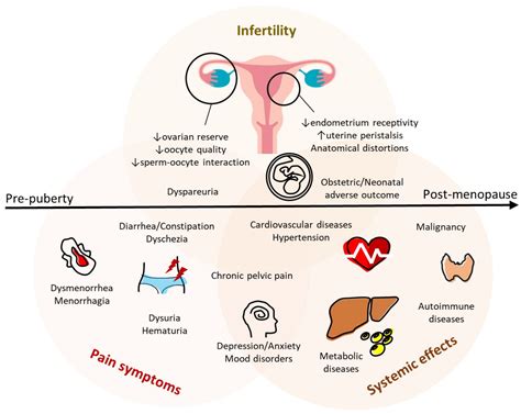 A Lifelong Impact on Endometriosis: Pathophysiology and Pharmacological