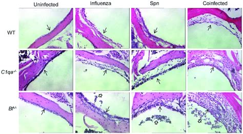 Representative Hande Stained Middle Ear Sections Middle Ear Inflammation