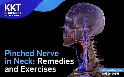 Pinched Nerve in Neck: Remedies and Exercises - KKT Pakistan | Pakistan's Only Non-Invasive ...