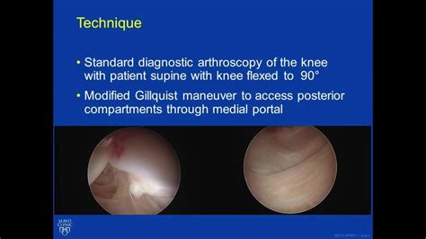 Dualposteromedial Portal Technique For Complex Arthroscopy In The