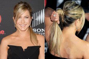 Top Celebrities Caught With Cupping Bruises You Wont Believe Ms