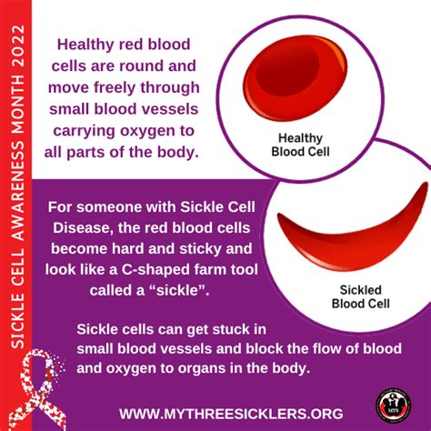 FREE Sickle Cell Information – MTS Sickle Cell Foundation, Inc.