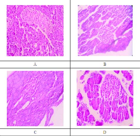 Histology Of Rat Pancreas After 15 Days Of Treatment With Ethanol