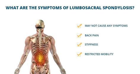 Lumbar Spondylosis What Is It