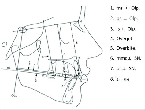 Sagittal And Vertical Dental Linear Measurements Sagittal Dental Download Scientific Diagram