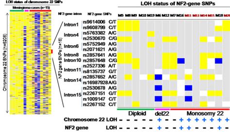 Neurofibromatosis Type 2 Chromosome 22