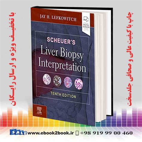 Scheuers Liver Biopsy Interpretation 10th Edition فروشگاه کتاب ایبوک