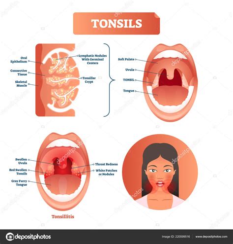 Tonsils Anatomy Diagram