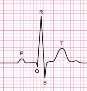 PQRST - Medical Exam Prep