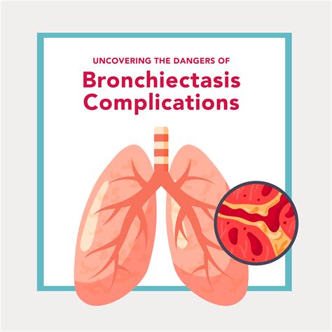 Bronchiectasis Complications Whats At Risk Smartvest