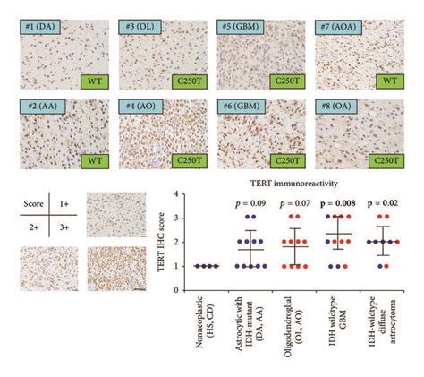 Association Of Tert Promoter Mutations And Its Immunoreactivity In