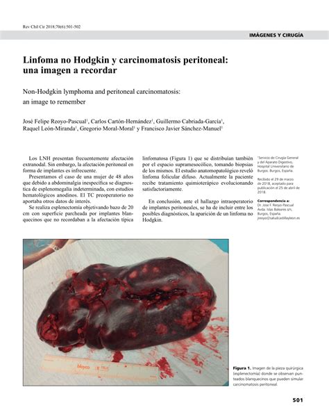 PDF Linfoma No Hodgkin Y Carcinomatosis Peritoneal Una Imagen A Recordar