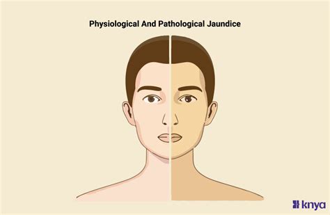 Understanding the Difference Between Physiological and Pathological ...