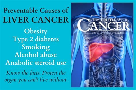 Statistics And Causes Of Liver Cancer