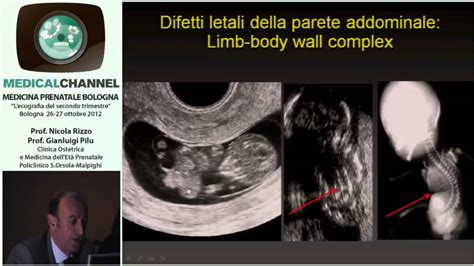 L Ecografia Del Secondo Trimestre Corso In HD YouTube