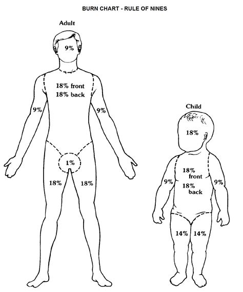 Burn Chart Pa Medic