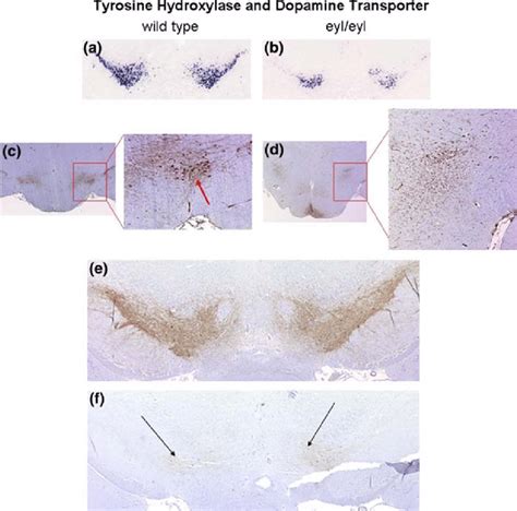 Expression Of Tyrosine Hydroxylase And Dopamine Transporter 1 In Download Scientific Diagram