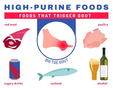 Foods That Cause Gout