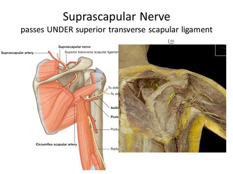 Transverse Scapular Ligament