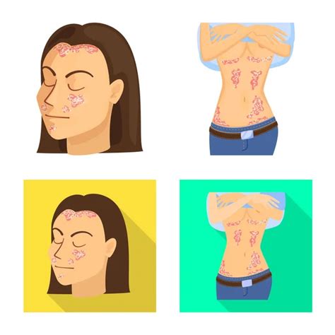 Diagnostico Psoriasis Imágenes De Stock De Arte Vectorial Depositphotos