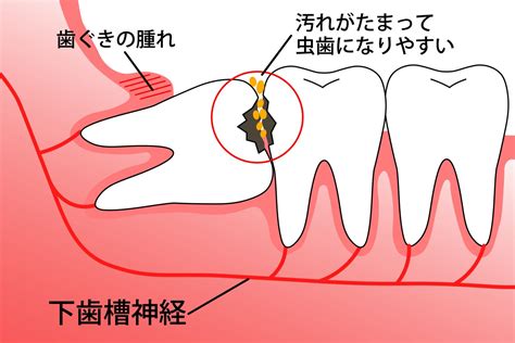 親知らずの抜歯なら柏駅の歯医者・歯科の岡田歯科クリニック