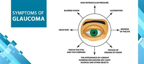 Glaucoma tipos síntomas causas tratamiento y prevención