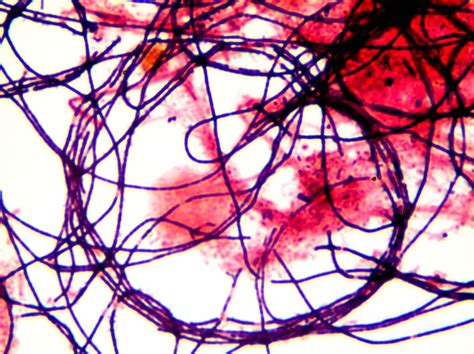 Bacterias Filamentosas Presentes En El Fango Activo MICROTHRIX PARVICELLA