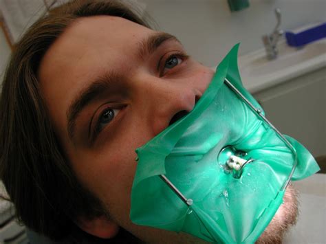 Dental Dam Alchetron The Free Social Encyclopedia