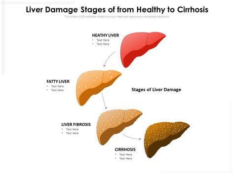 Liver Damage Stages Of From Healthy To Cirrhosis Ppt Powerpoint