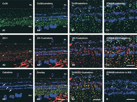 Triple Immunofluorescence Labeling Showing The Distribution Of Cx