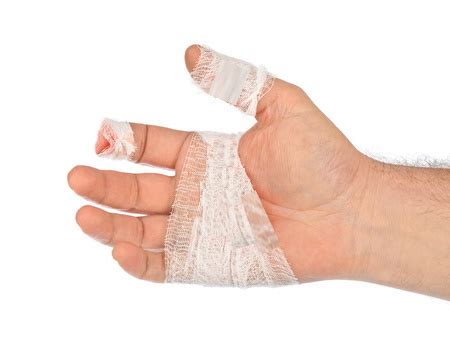 How To Make A Partial Finger Amputation Compensation Claim