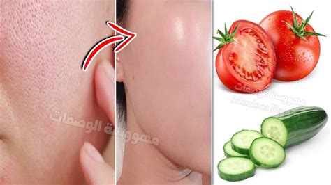 How To Get Rid Of Large Open Pores Permanently Skin Repair Close