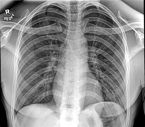 Mobile Digital X-ray - QMX Mobile HealthQMX Mobile Health