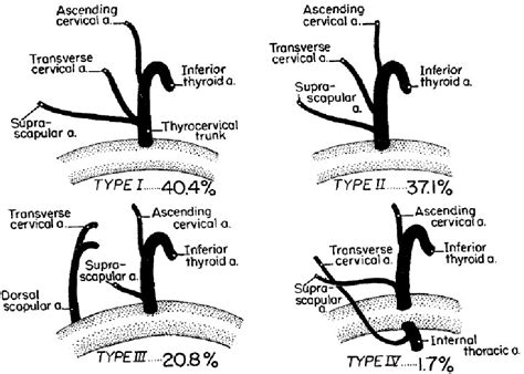 Figure 4 From Variations In Patterns Of Branching Of The Thyrocervical Trunk Semantic Scholar