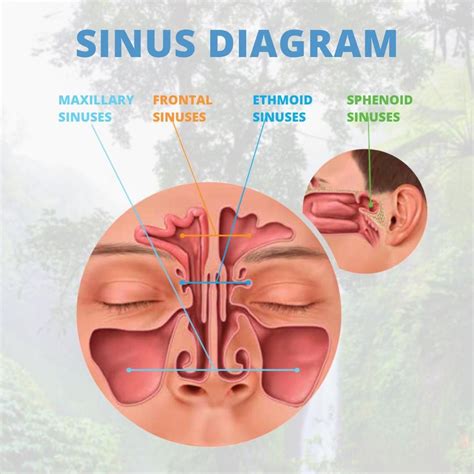 Side Effects Of Sinus Problems