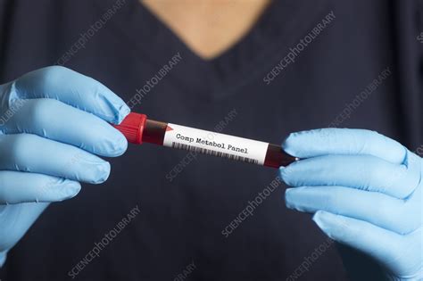 Comprehensive metabolic panel blood test - Stock Image - F035/9646 ...